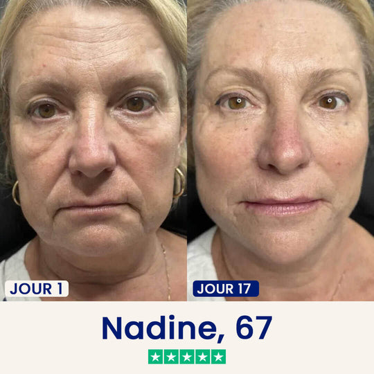 2 Masques Chinology™ Lift