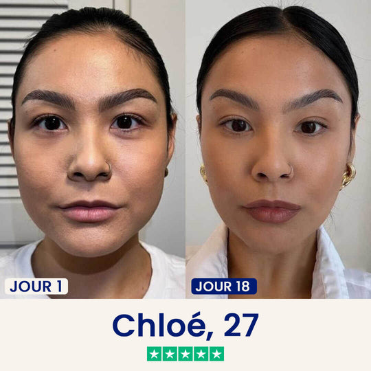2 Masques Chinology™ Lift